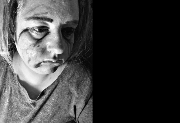 Schwarzes und weißes Foto einer Frau mit Gesichtsverletzungen, ernster Miene, konzentriertem Blick, zurückgebundenem Haar, T-Shirt tragend.